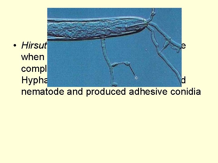  • Hirsutella rhossilliensis at a later stage when the body contents have been