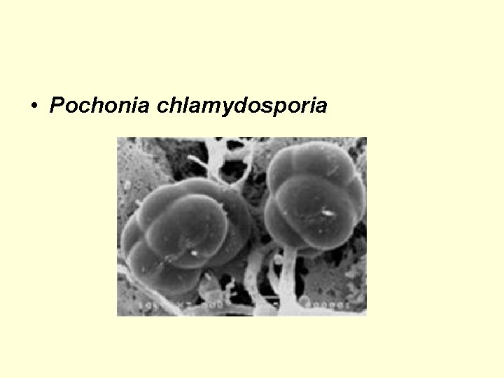  • Pochonia chlamydosporia 