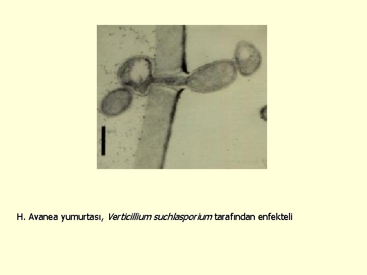 H. Avanea yumurtası, Verticillium suchlasporium tarafından enfekteli 