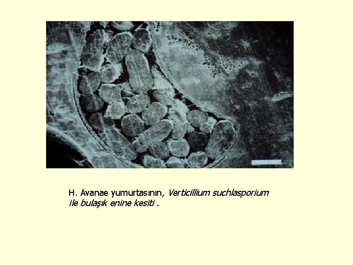 H. Avanae yumurtasının, Verticillium suchlasporium ile bulaşık enine kesiti. 