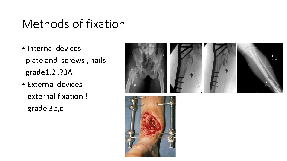 Methods of fixation • Internal devices plate and screws , nails grade 1, 2