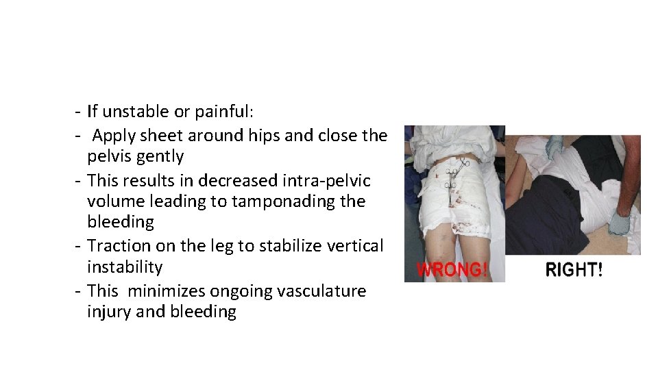 ‐ If unstable or painful: ‐ Apply sheet around hips and close the pelvis