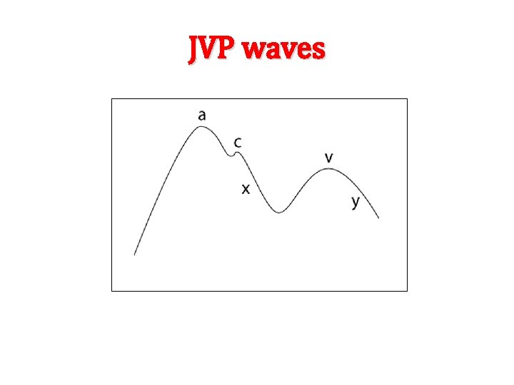 JVP waves 