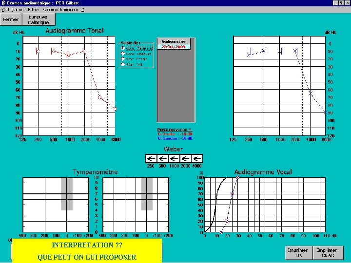 INTERPRETATION ? ? QUE PEUT ON LUI PROPOSER 