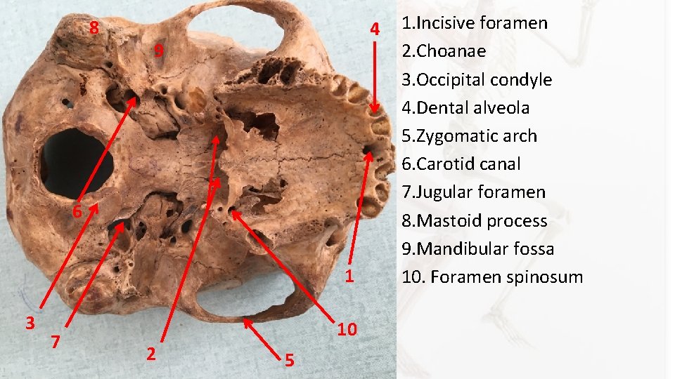 8 4 9 6 1 3 7 10 2 5 1. Incisive foramen 2. 8 4 9 6 1 3 7 10 2 5 1. Incisive foramen 2.