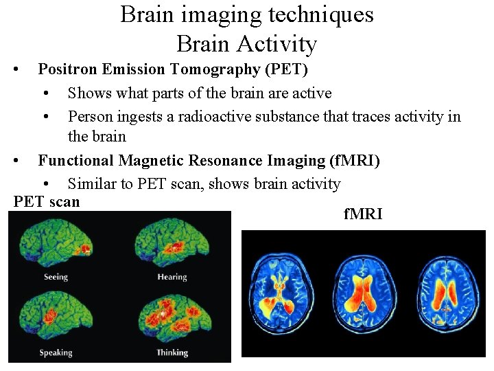 Brain imaging techniques Brain Activity • Positron Emission Tomography (PET) • Shows what parts