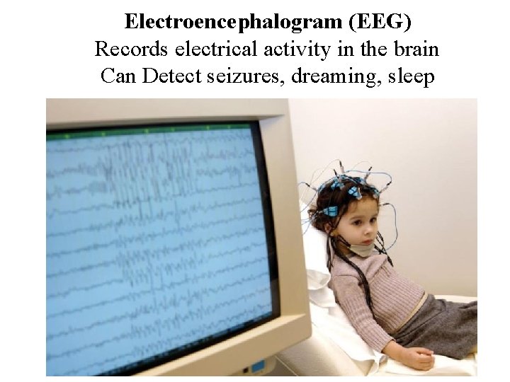Electroencephalogram (EEG) Records electrical activity in the brain Can Detect seizures, dreaming, sleep 