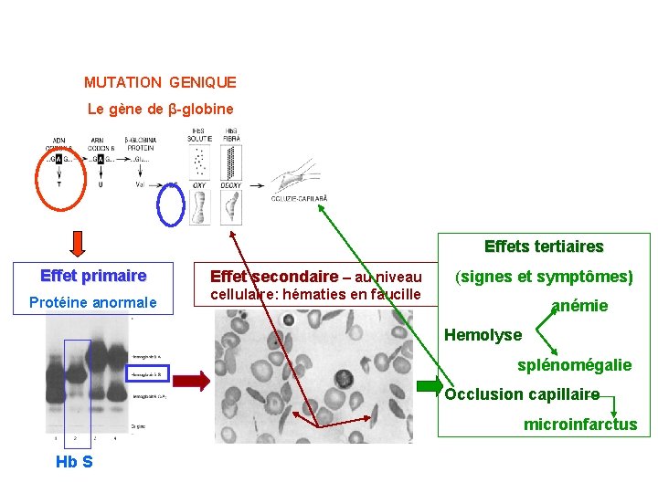 MUTATION GENIQUE Le gène de β-globine Effets tertiaires Effet primaire Protéine anormale Effet secondaire