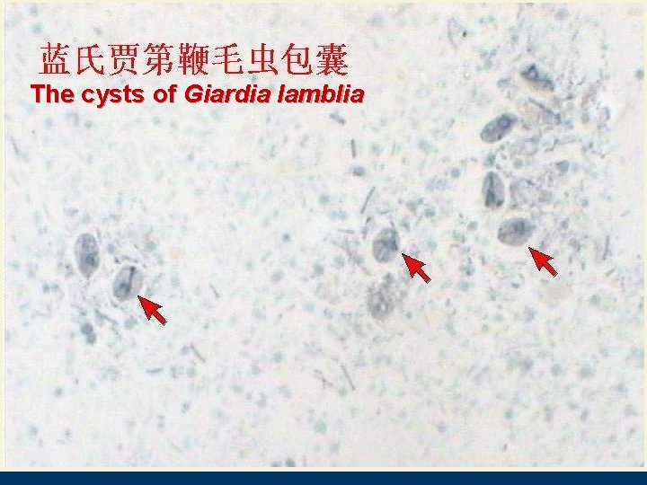 The cysts of Giardia lamblia 