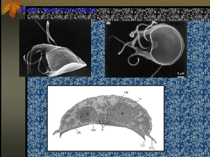 Giardia – Electron micrographs 