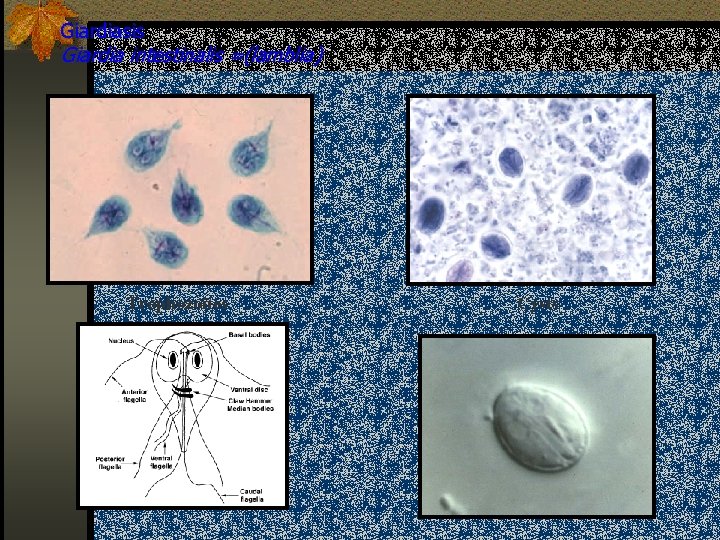 Giardiasis Giardia intestinalis =(lamblia) Trophozoites Cysts 