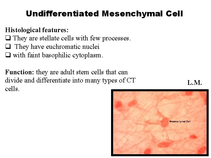 Undifferentiated Mesenchymal Cell Histological features: q They are stellate cells with few processes. q
