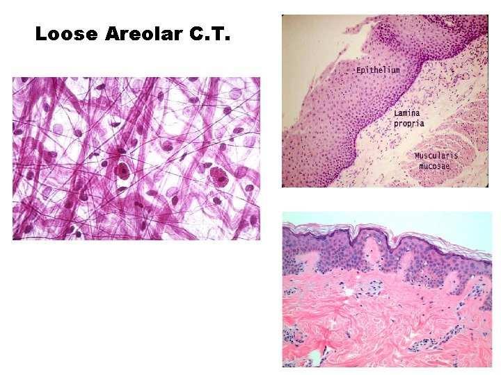 Loose Areolar C. T. 