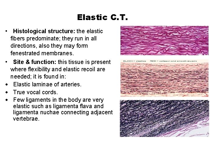 Elastic C. T. • Histological structure: the elastic fibers predominate; they run in all