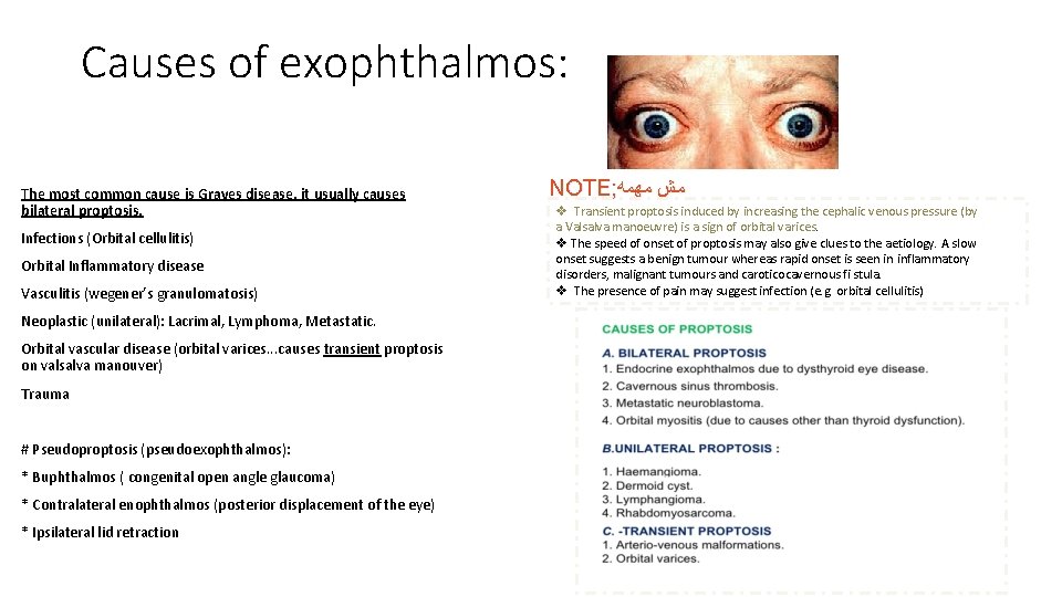 Causes of exophthalmos: The most common cause is Graves disease, it usually causes bilateral