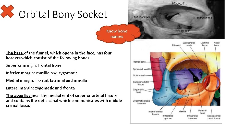 Orbital Bony Socket Know bone names The base of the funnel, which opens in