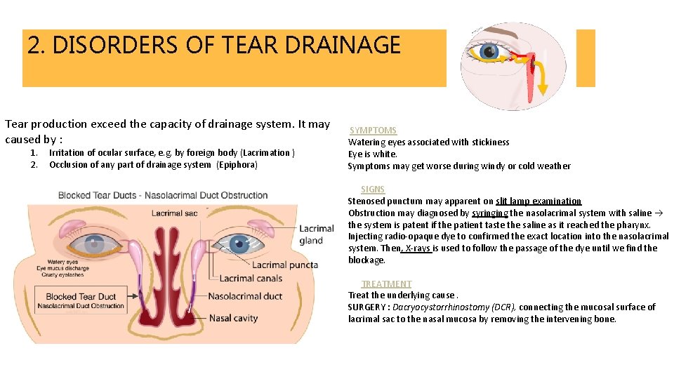 2. DISORDERS OF TEAR DRAINAGE Tear production exceed the capacity of drainage system. It