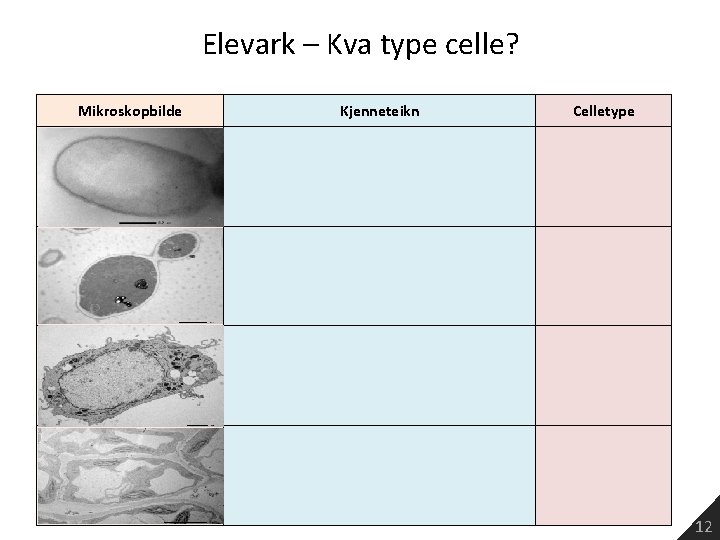 Elevark – Kva type celle? Mikroskopbilde Kjenneteikn Celletype 12 