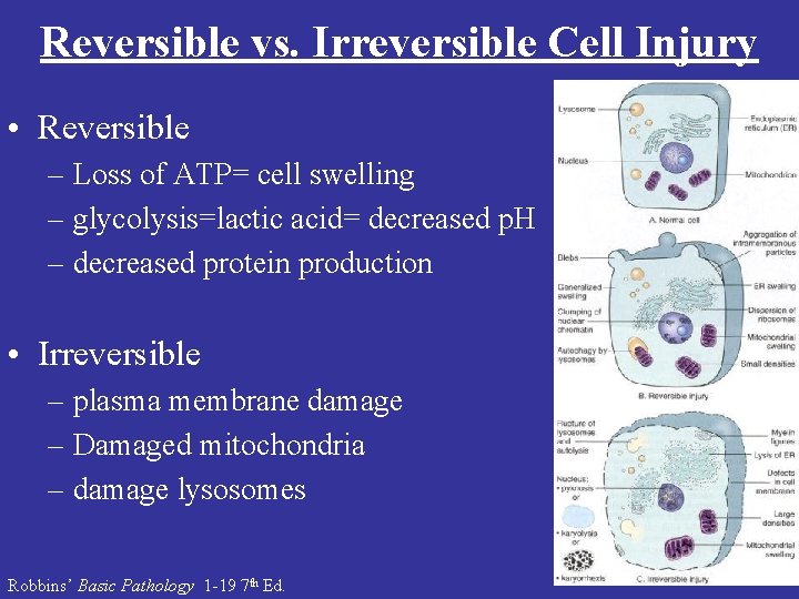 Reversible vs. Irreversible Cell Injury • Reversible – Loss of ATP= cell swelling –