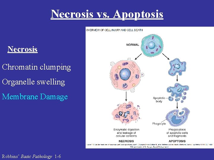 Necrosis vs. Apoptosis Necrosis Chromatin clumping Organelle swelling Membrane Damage Robbins’ Basic Pathology 1