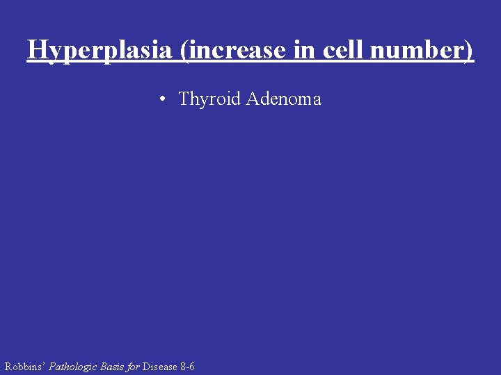 Hyperplasia (increase in cell number) • Thyroid Adenoma Robbins’ Pathologic Basis for Disease 8