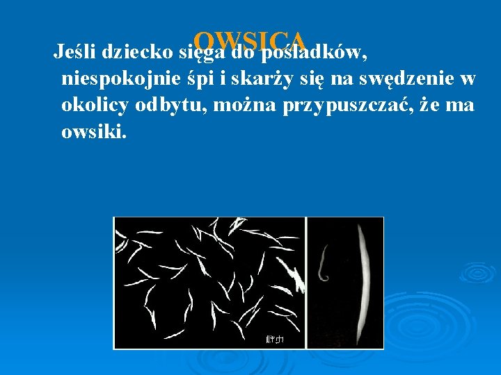 OWSICA Jeśli dziecko sięga do pośladków, niespokojnie śpi i skarży się na swędzenie w