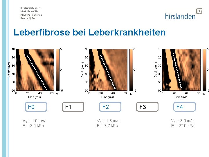 Hirslanden Bern Klinik Beau-Site Klinik Permanence Salem-Spital Leberfibrose bei Leberkrankheiten 10 5 10 0