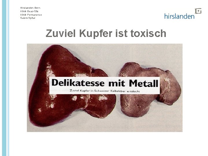 Hirslanden Bern Klinik Beau-Site Klinik Permanence Salem-Spital Zuviel Kupfer ist toxisch 