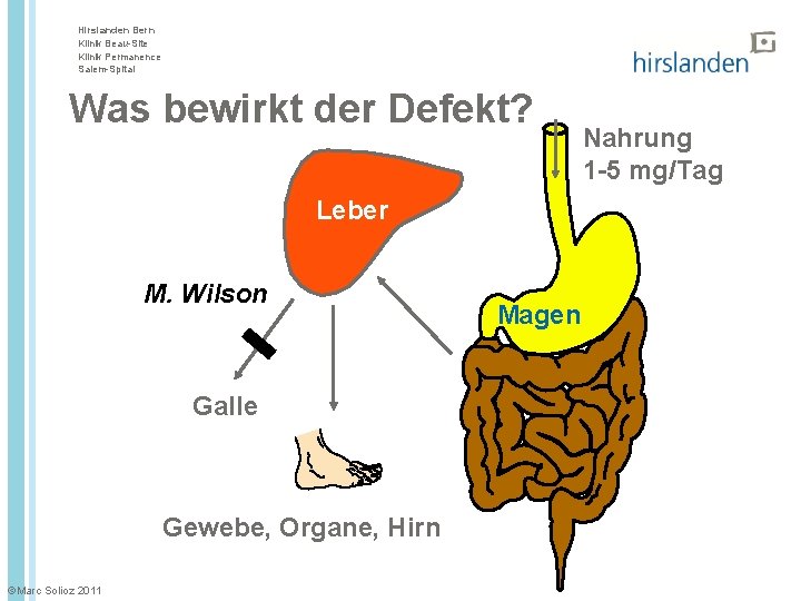 Hirslanden Bern Klinik Beau-Site Klinik Permanence Salem-Spital Was bewirkt der Defekt? Leber M. Wilson