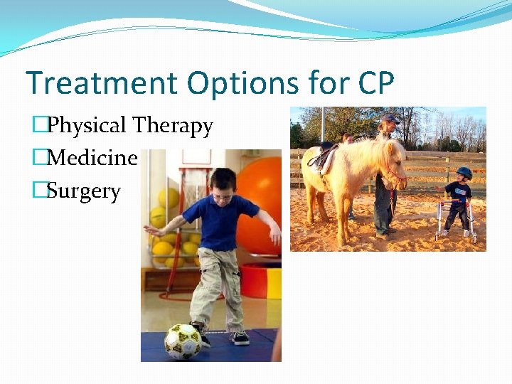 Treatment Options for CP �Physical Therapy �Medicine �Surgery 