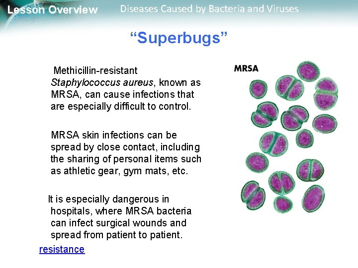 Lesson Overview Diseases Caused by Bacteria and Viruses “Superbugs” Methicillin-resistant Staphylococcus aureus, known as