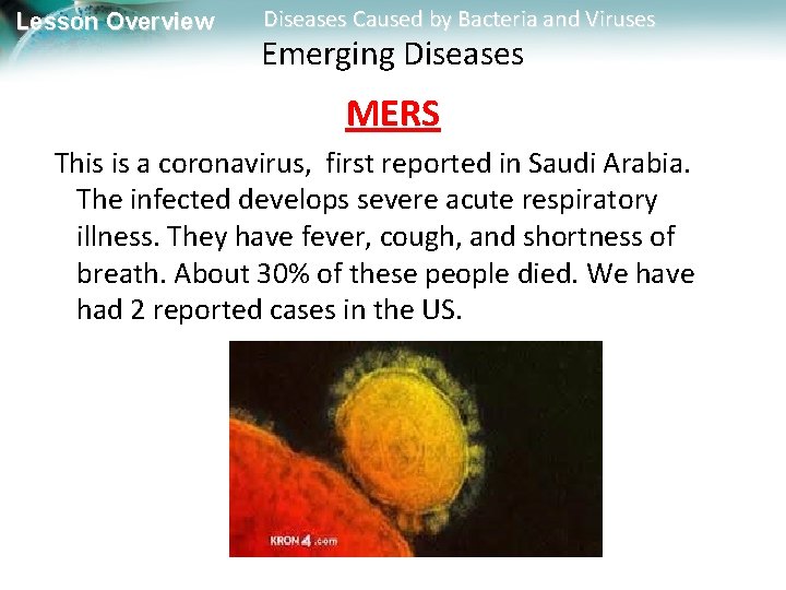 Lesson Overview Diseases Caused by Bacteria and Viruses Emerging Diseases MERS This is a