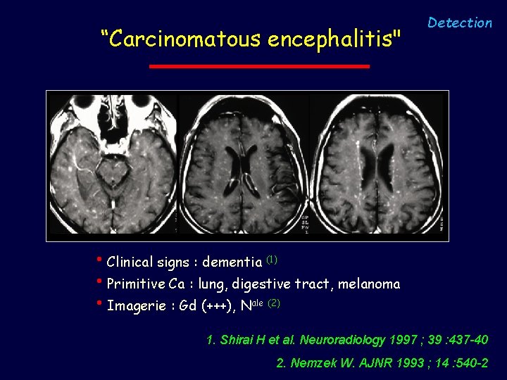 “Carcinomatous encephalitis" Detection • Clinical signs : dementia (1) • Primitive Ca : lung,