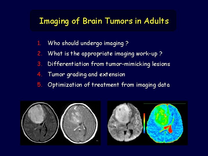 Imaging of Brain Tumors in Adults 1. Who should undergo imaging ? 2. What