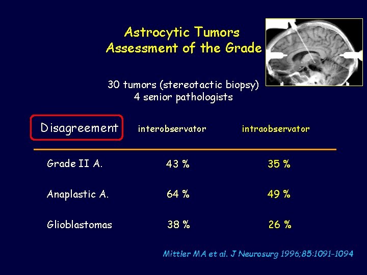 Astrocytic Tumors Assessment of the Grade 30 tumors (stereotactic biopsy) 4 senior pathologists Disagreement