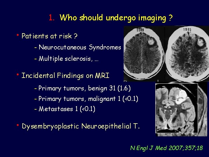 1. Who should undergo imaging ? • Patients at risk ? - Neurocutaneous Syndromes