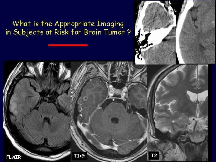 What is the Appropriate Imaging in Subjects at Risk for Brain Tumor ? FLAIR