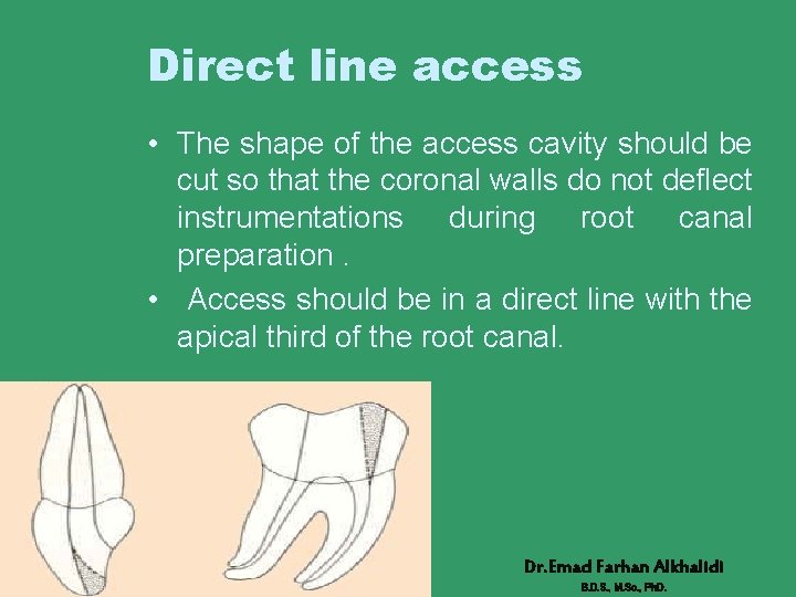 Direct line access • The shape of the access cavity should be cut so