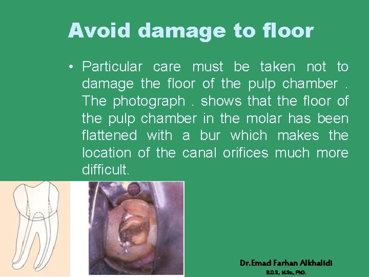 Avoid damage to floor • Particular care must be taken not to damage the