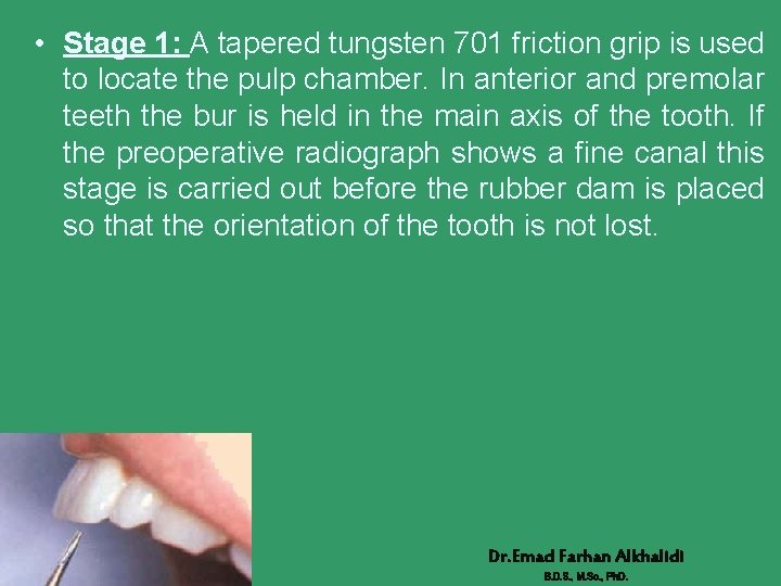  • Stage 1: A tapered tungsten 701 friction grip is used to locate