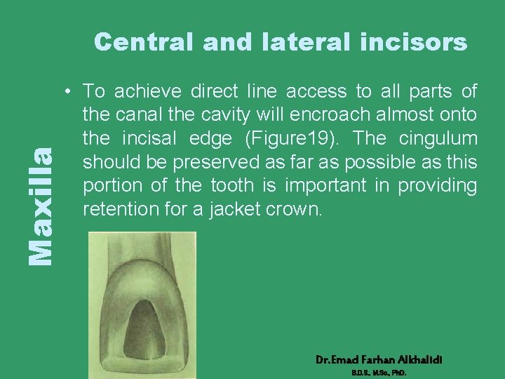 Maxilla Central and lateral incisors • To achieve direct line access to all parts