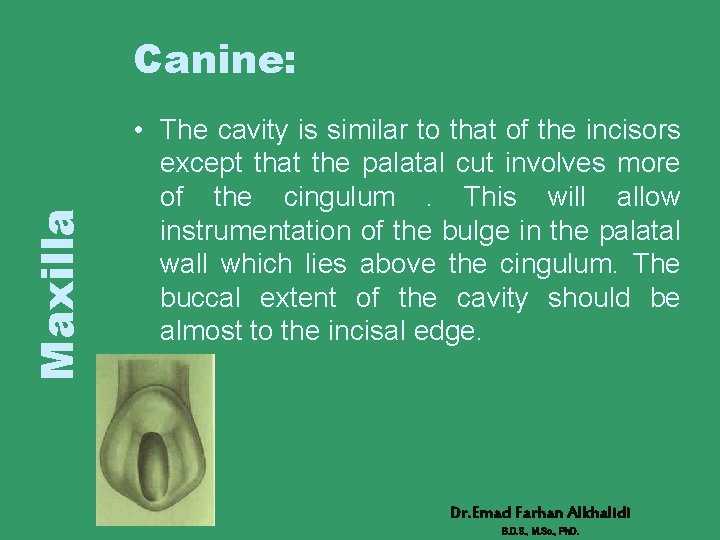 Maxilla Canine: • The cavity is similar to that of the incisors except that