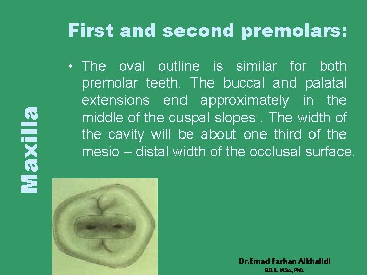 Maxilla First and second premolars: • The oval outline is similar for both premolar