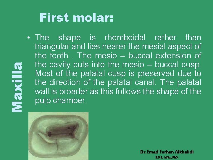Maxilla First molar: • The shape is rhomboidal rather than triangular and lies nearer