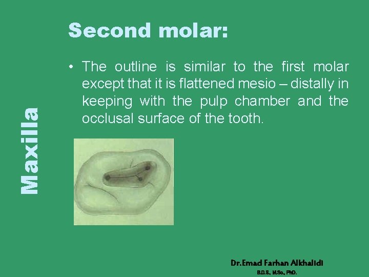 Maxilla Second molar: • The outline is similar to the first molar except that