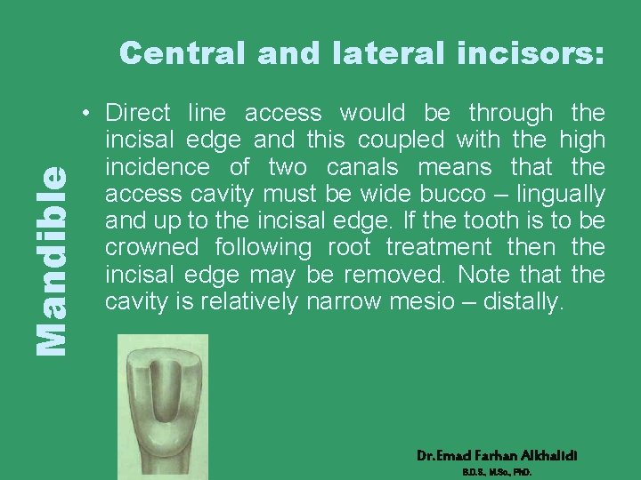 Mandible Central and lateral incisors: • Direct line access would be through the incisal