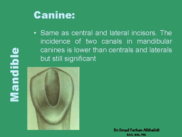 Mandible Canine: • Same as central and lateral incisors. The incidence of two canals