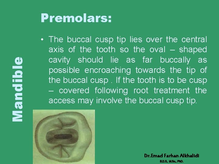 Mandible Premolars: • The buccal cusp tip lies over the central axis of the