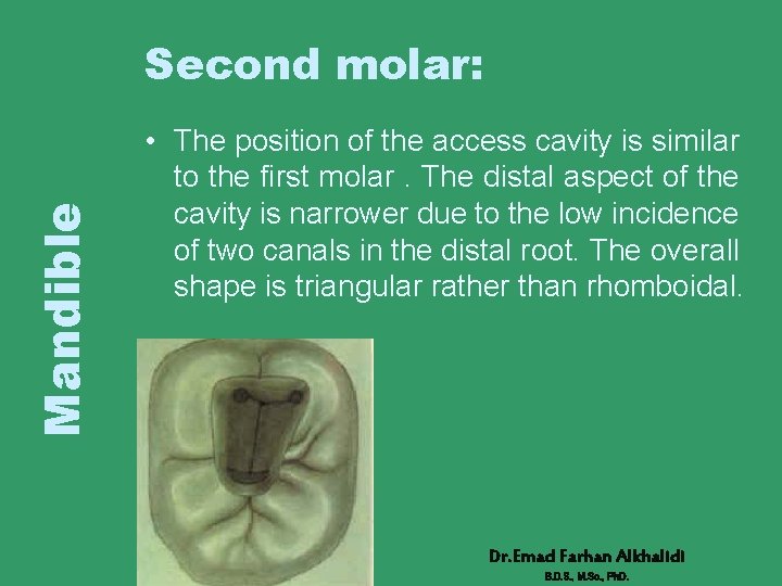 Mandible Second molar: • The position of the access cavity is similar to the
