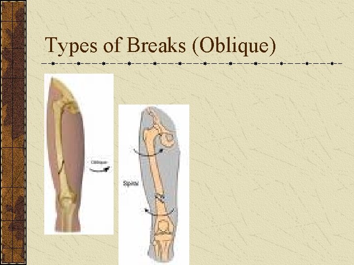 Types of Breaks (Oblique) 